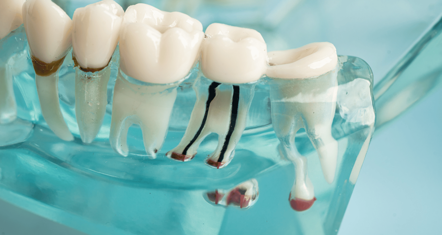 Dental Nerve Damage