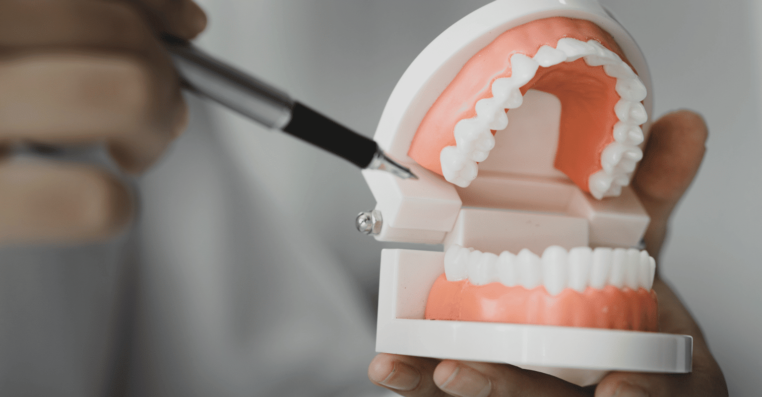 How Much Do Braces Cost In Tennessee?